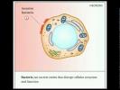 Necrosis VS apoptosis - www.bahriandoctors.com -