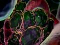 APOPTOSIS